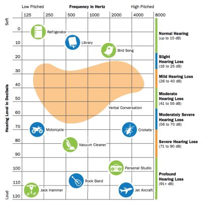 A chart showing sound frequencies and decibel levels, illustrating types of hearing loss and common everyday sounds.